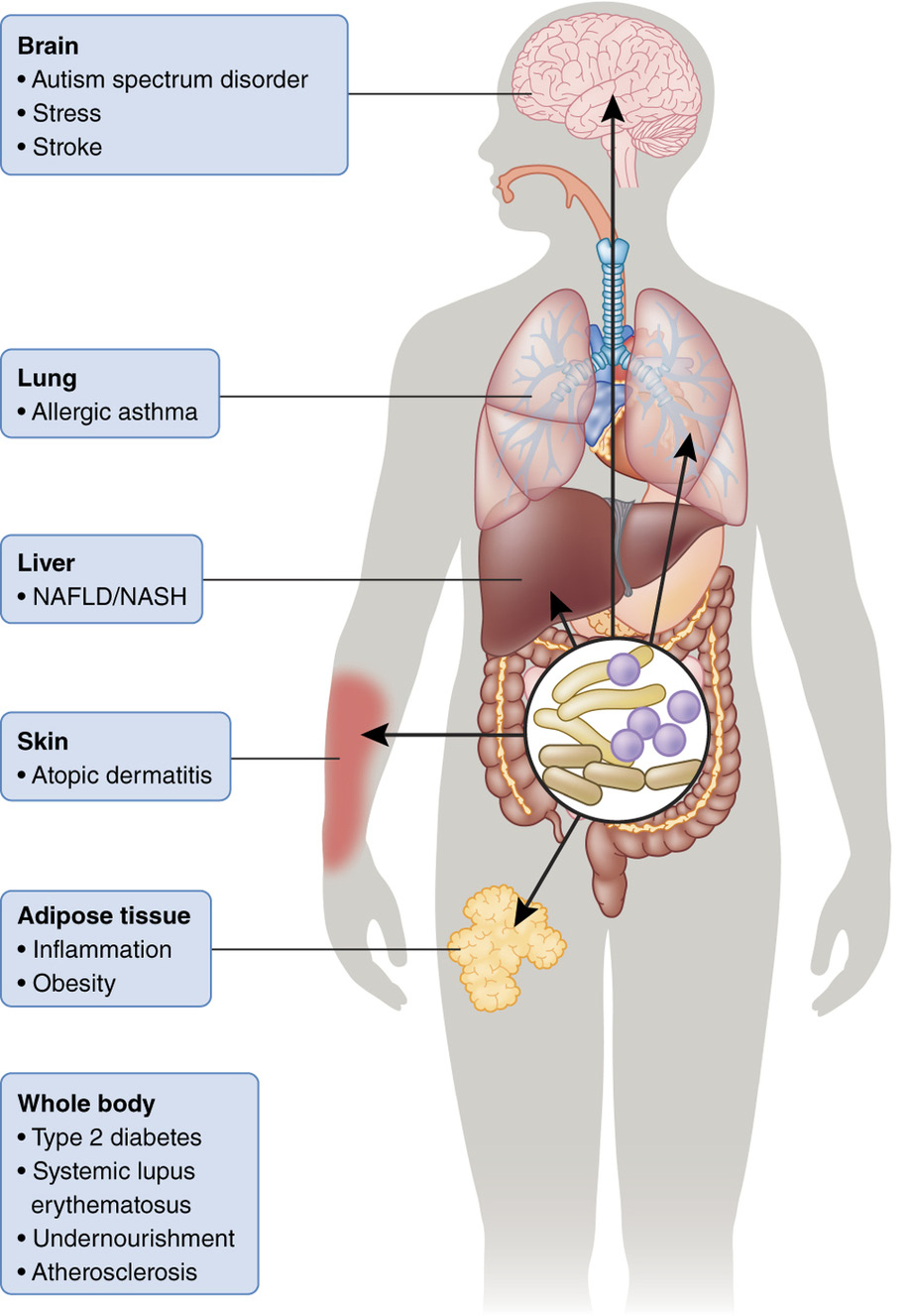 Microbiome Changes and Effects on the Body .jpg